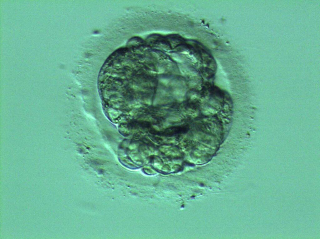 Embryo Pic Header Fertility Spot