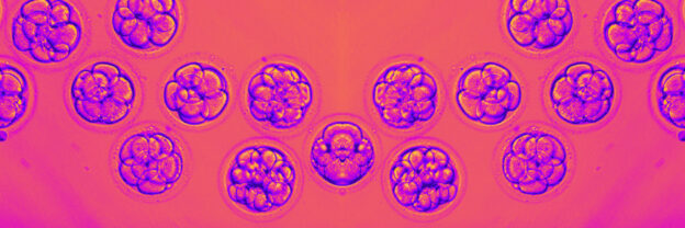 Euploid vs Aneuploid Embryo