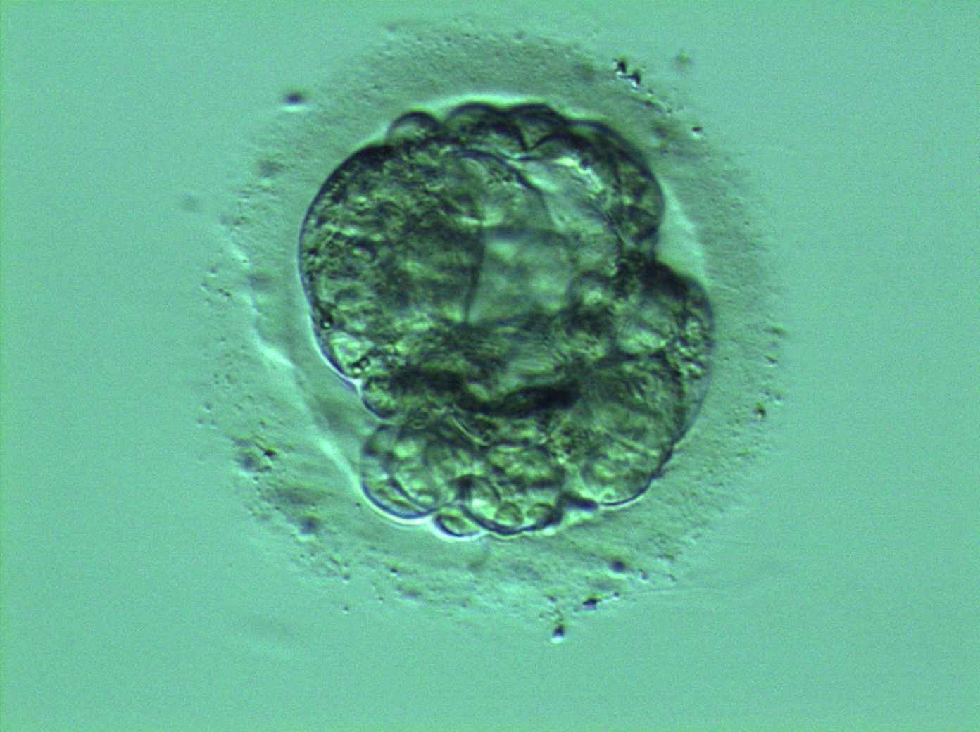 00y0B2vBN4kA-Embryo-Pic-Header-Fertility-Spot.jpg